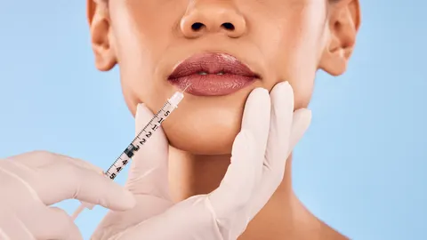 Minimalinvasive Injektionsbehandlung im Gesicht und Halsbereich